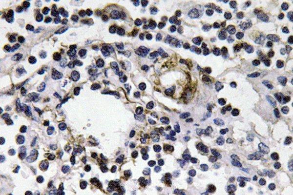 Immunohistochemistry (IHC) analyzes of IFN-γ (Q69) pAb in paraffin-embedded human lymph node tissue