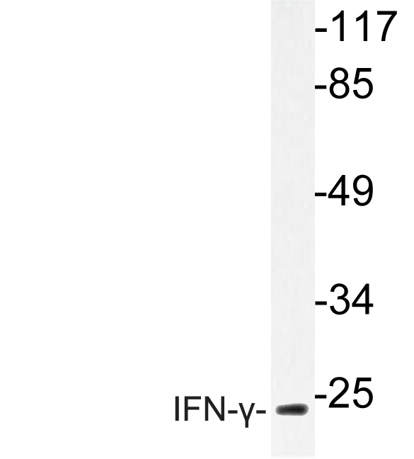 Western blot (WB) analysis of IFN-γ (Q69) polyclonal antibody at 1:500 dilution
Lane1:HEK293T whole cell lysate
Lane2:Raw264