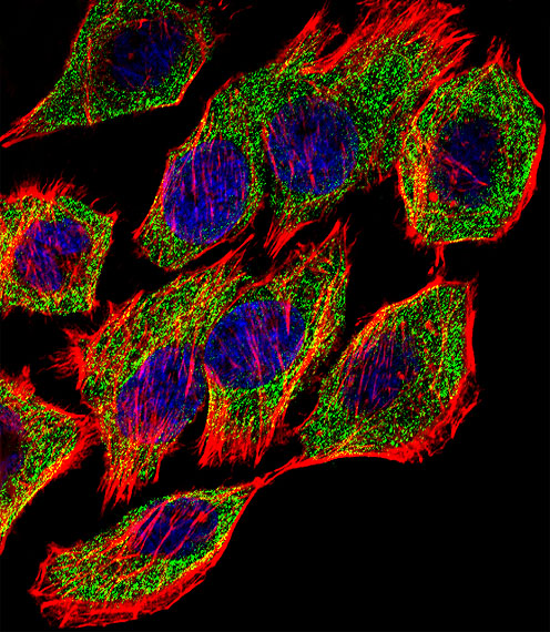 a00394 2 anti gstp1 antibody center if testing 1