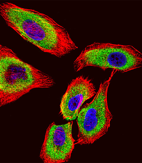 a00394 2 anti gstp1 antibody center if testing 2