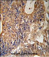 a00394 2 anti gstp1 antibody center ihc p testing 4