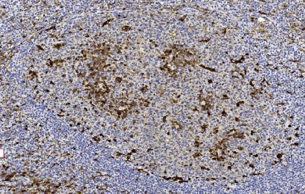 a00394 2 anti gstp1 antibody center ihc testing 6
