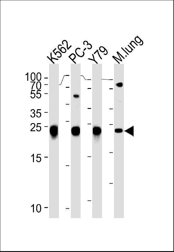 a00394 2 anti gstp1 antibody center wb testing 3