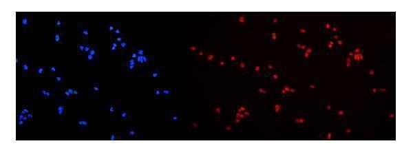a00396 1 hnrnp_a2b1 primary antibodies if testing 5