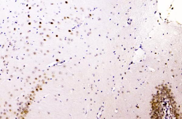a00396 1 hnrnp_a2b1 primary antibodies ihc testing 3