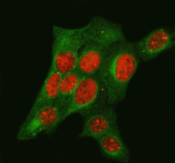  IF analysis of TP53BP1 using anti-TP53BP1 antibody (A00397-1) and anti-Beta Tubulin antibody (M01857-3)