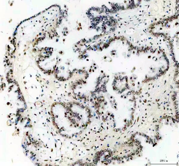 IHC analysis of TP53BP1 using anti-TP53BP1 antibody (A00397-1)