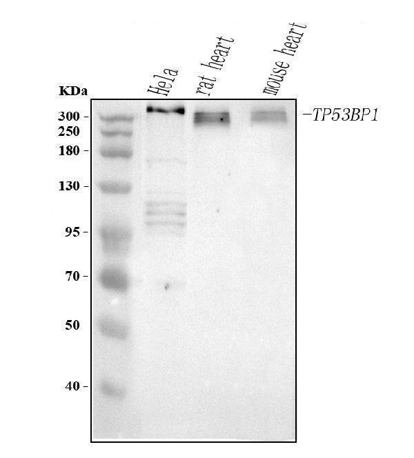  Western blot analysis of TP53BP1 using anti-TP53BP1 antibody (A00397-1)