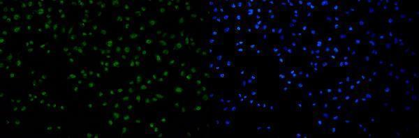 a00397 tp53bp1 primary antibodies if testing 10