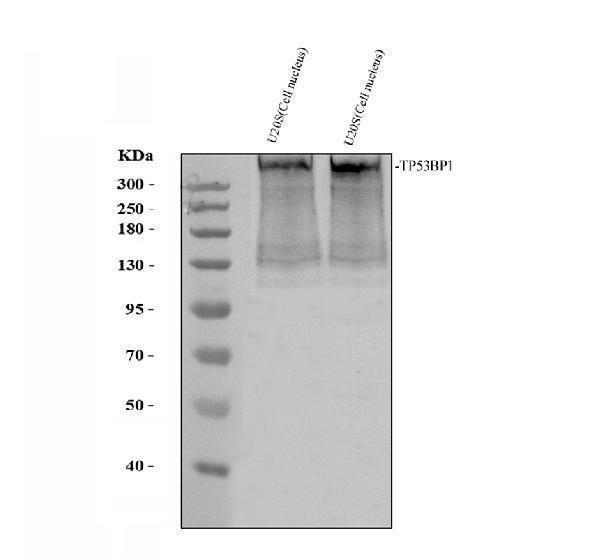 Western blot analysis of 53BP1/TP53BP1 using anti-53BP1/TP53BP1 antibody (A00397)