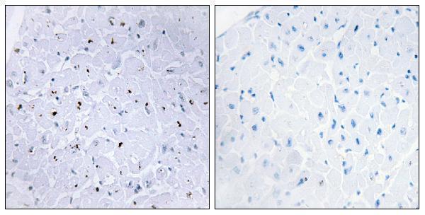 a00397s6 tp53bp1 primary antibodies ihc testing 1