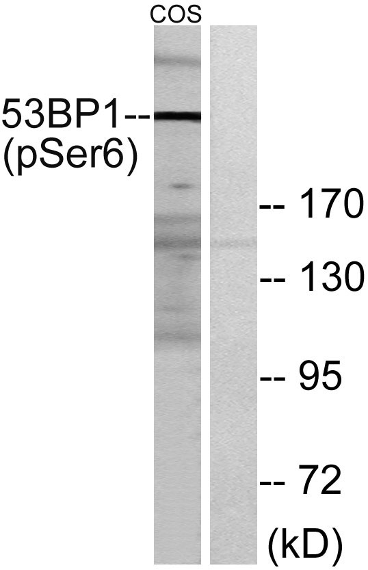 a00397s6 tp53bp1 primary antibodies wb testing 2
