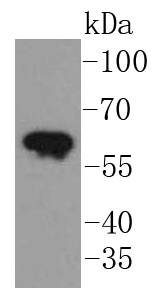 Western blot analysis of Cytokeratin 5 on A431 cells lysates using anti-Cytokeratin 5 antibody at 1/1,000 dilution