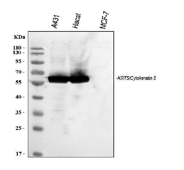 a00398 krt5 primary antibodies wb testing 1