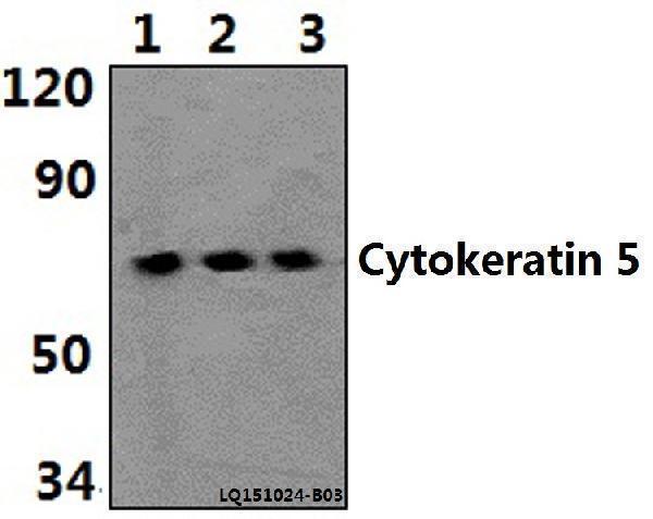 Western blot (WB) analysis of Cytokeratin 5 (S573) polyclonal antibody at 1:500 dilution
Lane1:HEK293T whole cell lysate(40ug)
Lane2:PC12 whole cell lysate(40ug)
Lane3:NIH-3T3 whole cell lysate(40ug)