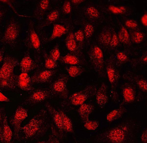 a00399 fli1 primary antibodies icc testing 3