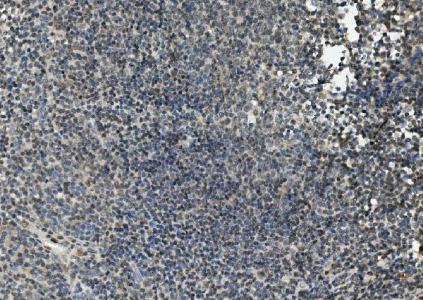 a00399 fli1 primary antibodies ihc testing 2