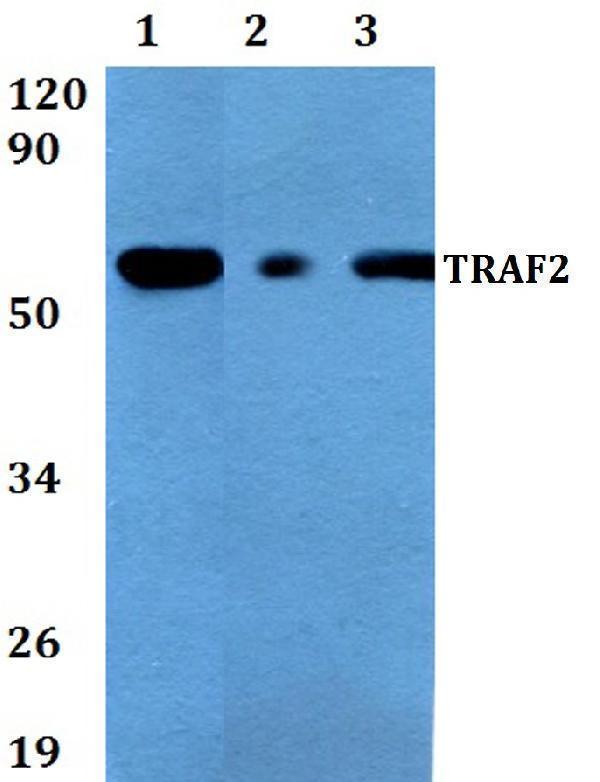 a00400s11 traf2 primary antiboties wb testing 1