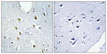a00401 1 irf4 primary antibodyes ihc testing 2