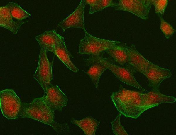 a00401 2 irf4 primary antibodies if testing 2