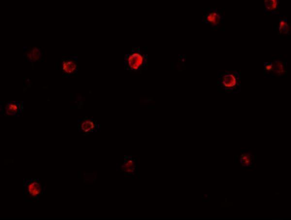 a00401 irf4 primary antibodies if testing 3