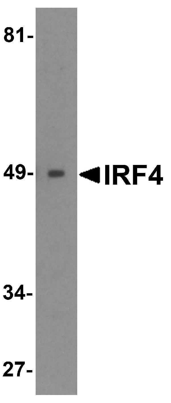 a00401 irf4 primary antibodies wb testing 1