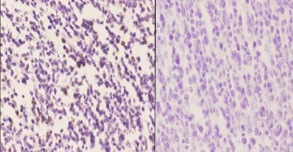 a00401y294 irf4 primary antiboties ihc testing 2