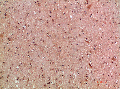 a00402 kmt2a primary antibodies ihc testing 1