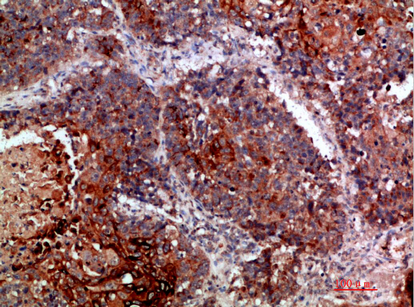 a00402 kmt2a primary antibodies ihc testing 2