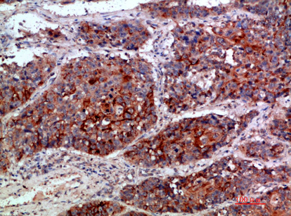 a00402 kmt2a primary antibodies ihc testing 3