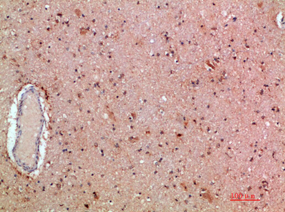 a00402 kmt2a primary antibodies ihc testing 4