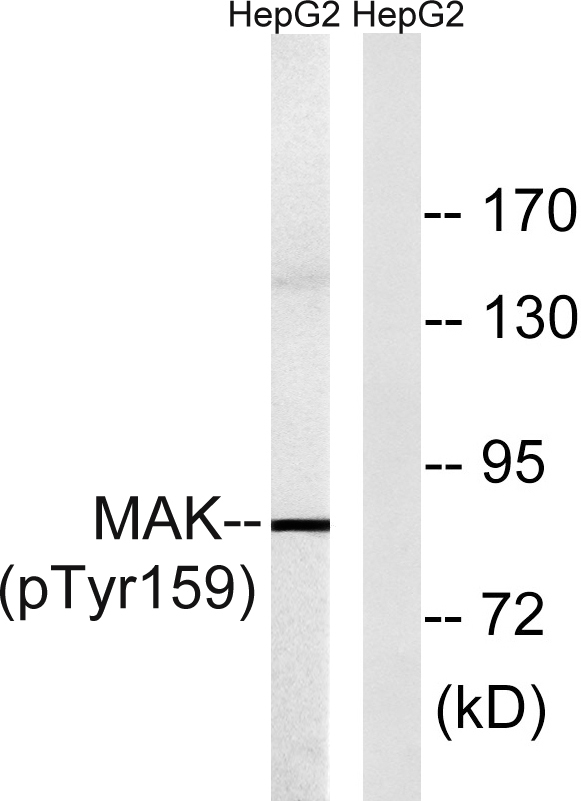 Western blot analysis of lysates from HepG2 cells treated with PMA 125ng/ml 30', using MAK (Phospho-Tyr159) Antibody