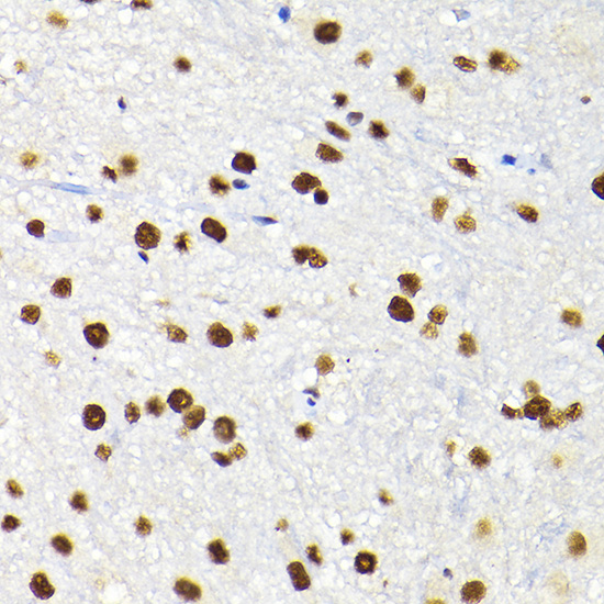 a00409 trim28 primary antiboties ihc testing 4