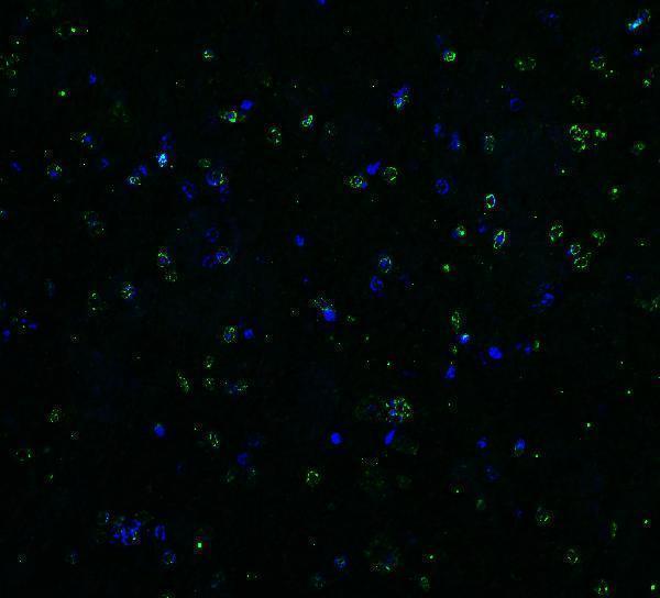 a00410 2 tnfrsf10b primary antibodies if testing 10