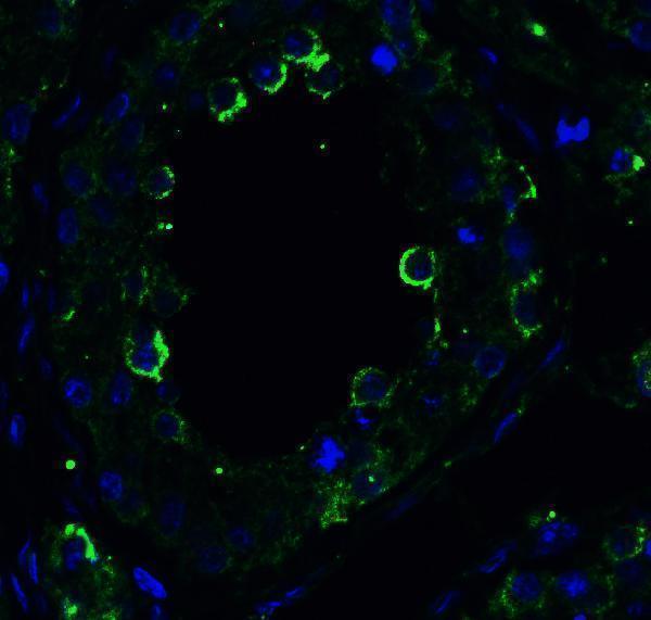 a00410 2 tnfrsf10b primary antibodies if testing 8