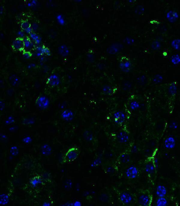 a00410 2 tnfrsf10b primary antibodies if testing 9