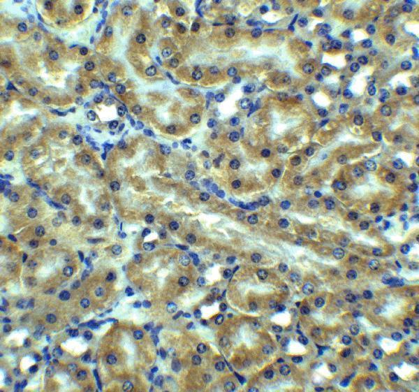 a00410 2 tnfrsf10b primary antibodies ihc testig 11