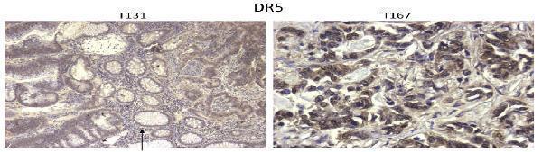a00410 2 tnfrsf10b primary antibodies ihc testing 14
