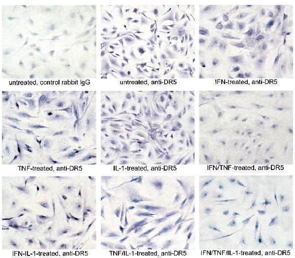 a00410 2 tnfrsf10b primary antibodies ihc testing 15