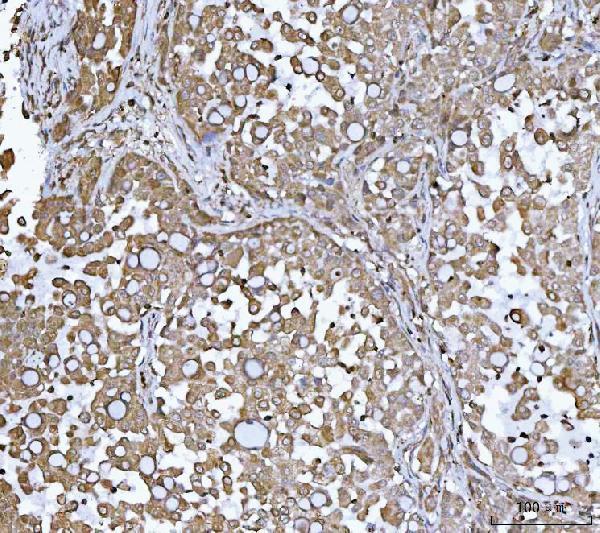  IHC analysis of DR5/TNFRSF10B using anti-DR5/TNFRSF10B antibody (A00410-5)