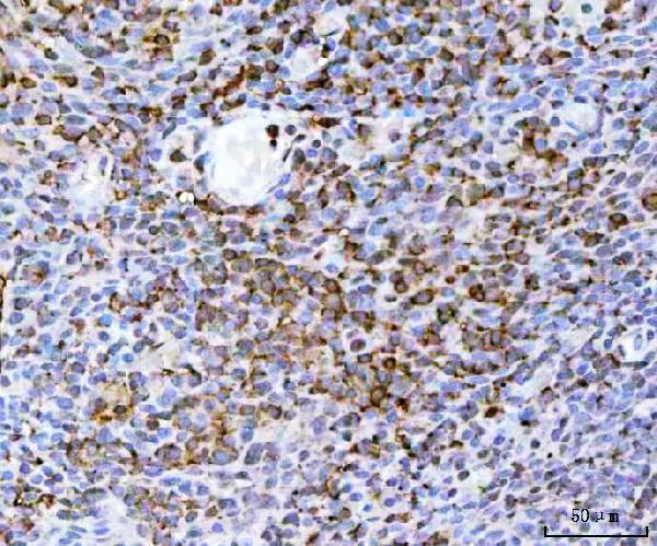 a00410 5 tnfrsf10b primary antibodies ihc testing 4