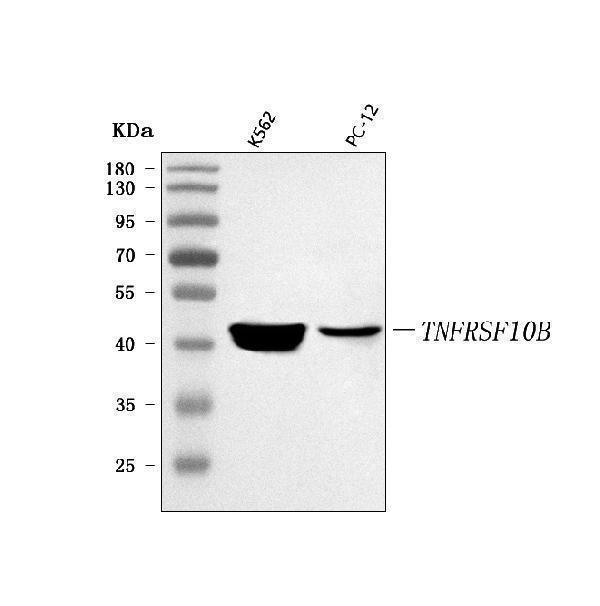  Western blot analysis of DR5/TNFRSF10B using anti-DR5/TNFRSF10B antibody (A00410-5)