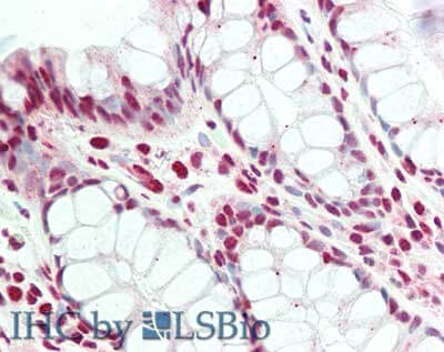 a00412 2 prdm1 primary antibodies ihc testing 1