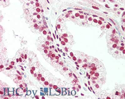 a00412 2 prdm1 primary antibodies ihc testing 2