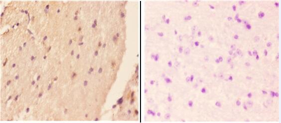 a00414 1 iapp primary antiboties ihc testing 2