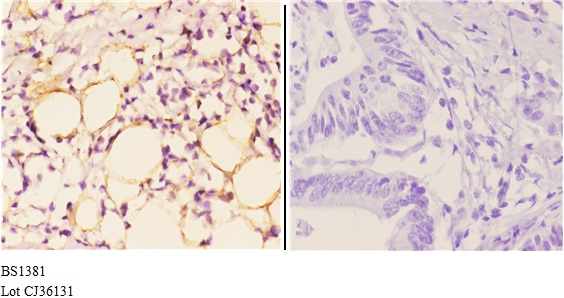 a00414 1 iapp primary antiboties ihc testing 3
