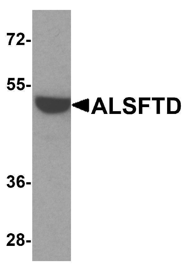 a00419 alsftd primary antibodies wb testing 1
