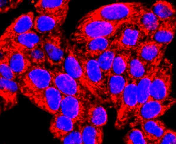 ICC staining MMP13 in Hela cells (red)