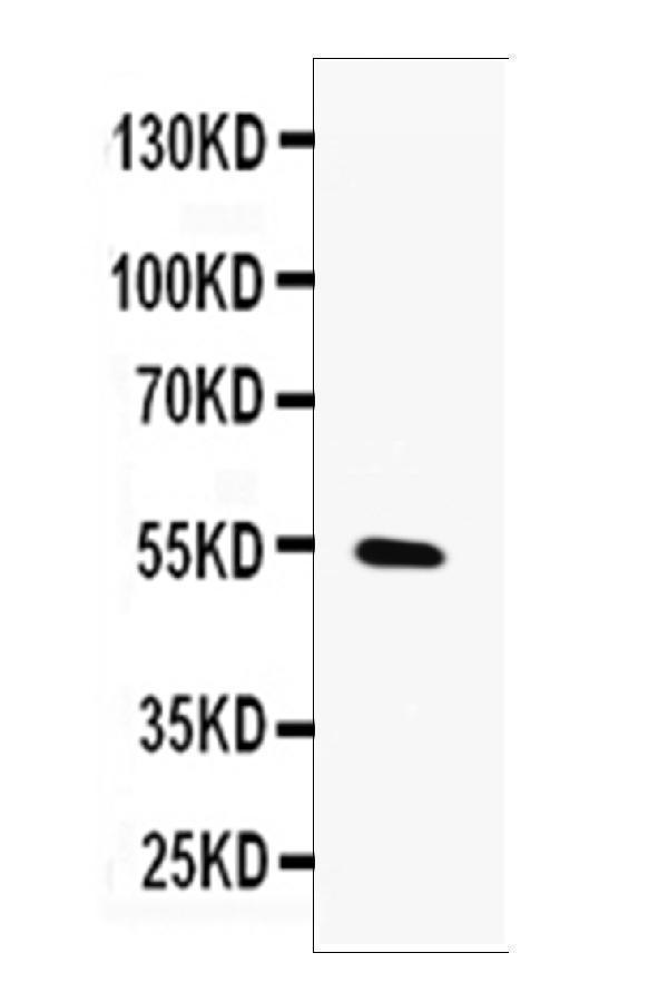  Western blot analysis of MMP13 using anti-MMP13 antibody (A00420)