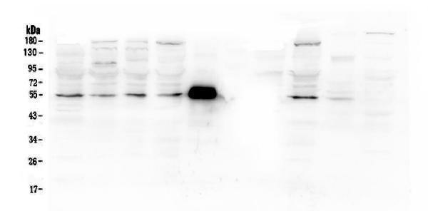  Western blot analysis of MMP13 using anti-MMP13 antibody (A00420)